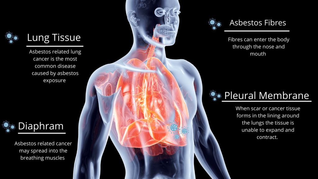 Asbestos Affects Health