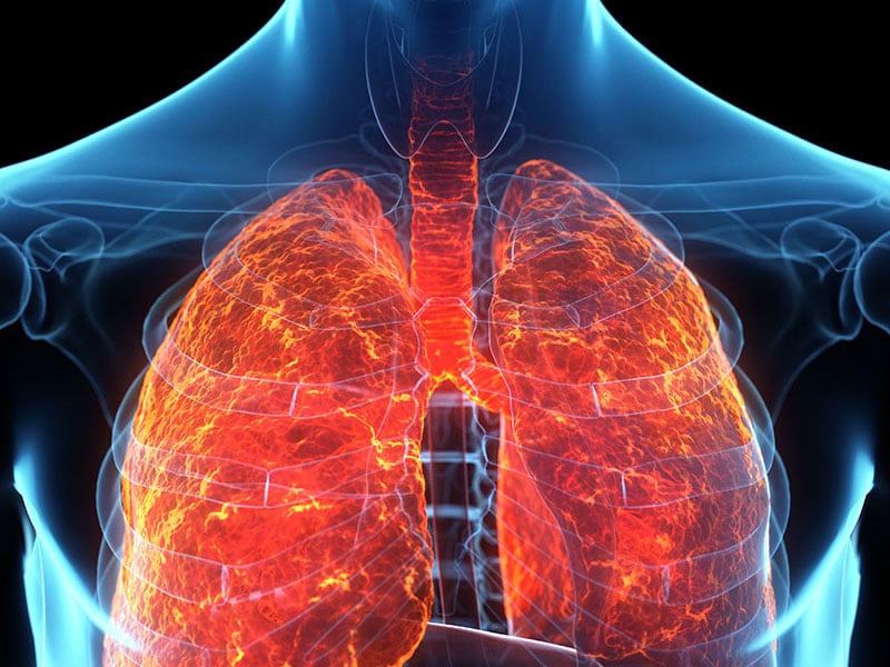 Signs of Asbestos Exposure